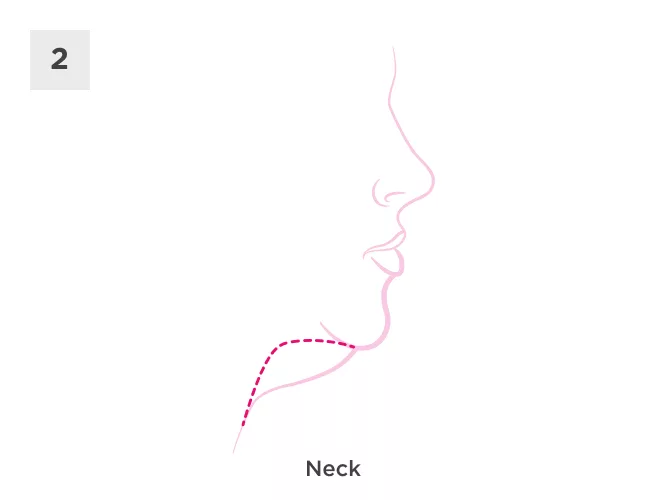 facelift-neck-brow-lift-process-step2