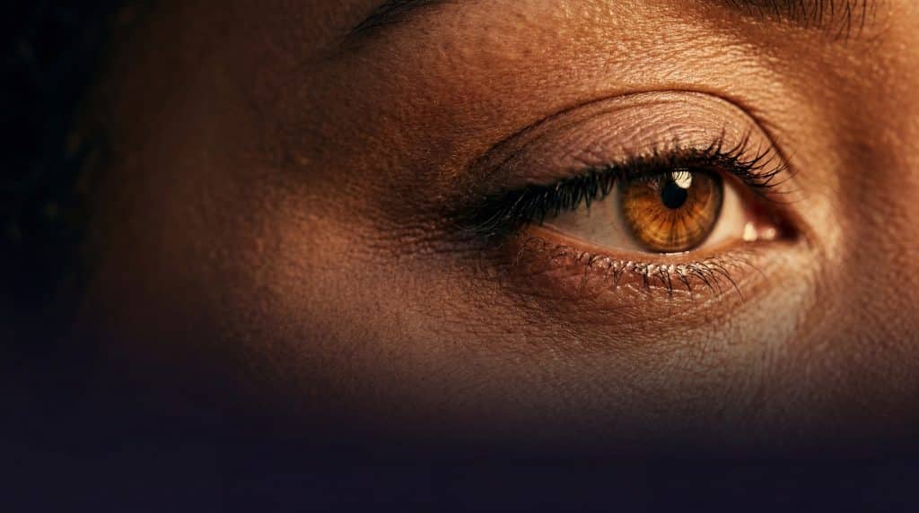 Close up image of an eye for the Transform Beverly Hills blepharoplasty treatment card